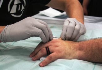 Amal Graafstra injecting an attendee with a RFID chip.